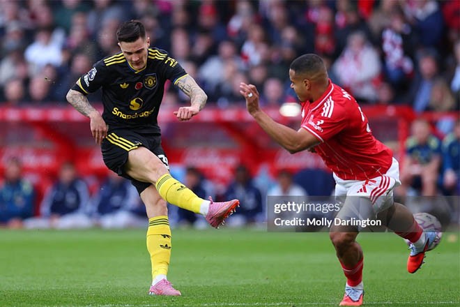 Trực tiếp bóng đá Nottingham Forest - MU: Lăn xả cứu bàn thua mười mươi (Ngoại hạng Anh) (Hết giờ) - 1