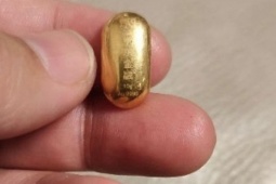 Bé trai 11 tuổi nuốt hạt đậu vàng 10 gram để 'rèn lưỡi'