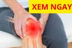 Tin tức sức khỏe - 4 tuyệt chiêu &quot;đánh bay&quot; cơn đau khớp khi chuyển mùa?