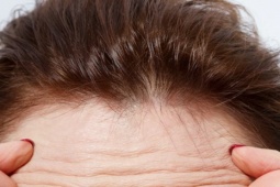 Thực phẩm bổ sung nào giúp chống lại nếp nhăn?