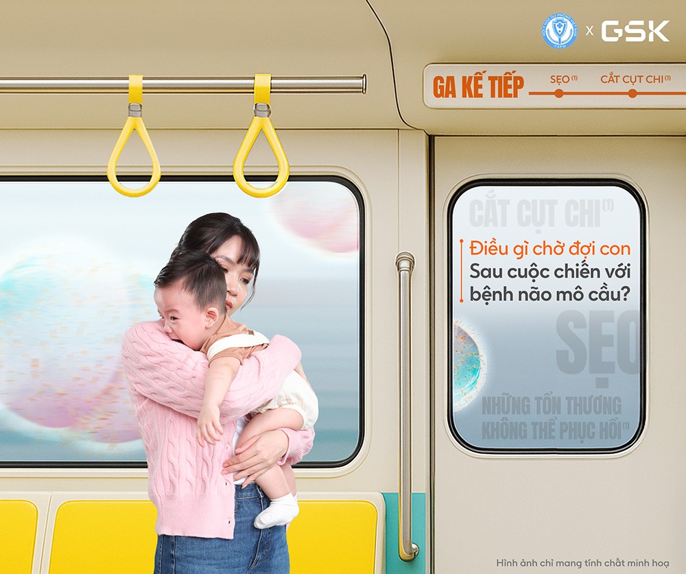 Một số biến chứng/di chứng của bệnh não mô cầu: Sẹo da, cùng với biến chứng cắt cụt chi, khiếm khuyết/di chứng thần kinh, mất/suy giảm thính lực, thị lực…(1)