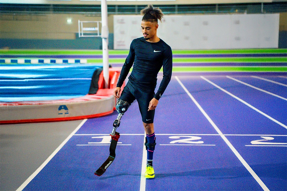 Flavio chịu các khuyết tật vĩnh viễn bởi bệnh do não mô cầu và là minh chứng sống cho sự nguy hiểm của căn bệnh - Ảnh: zbdtalent