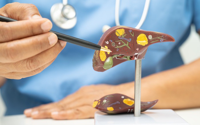 Thấy nước tiểu có 5 dấu hiệu này coi chừng gan đang "kêu cứu" - 1