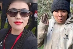 Cô gái xinh đẹp gầy rộc, tay nứt nẻ sau 14 ngày tham gia thử thách sinh tồn