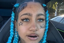 Làm đẹp - Bác sĩ cảnh báo mốt 'răng đen' của con gái Kim Kardashian