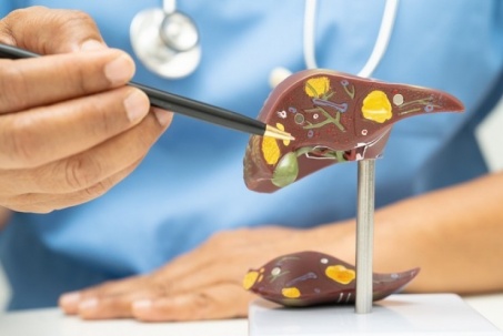 Thấy nước tiểu có 5 dấu hiệu này coi chừng gan đang "kêu cứu"