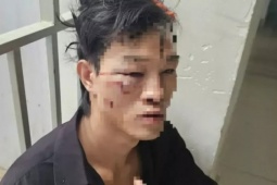 Đi ăn hủ tiếu khuya, thanh niên tỉnh dậy ở trạm xá với nhiều vết thương