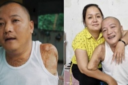 Mất 2 tay 1 chân sau tai nạn, người đàn ông tìm lại cuộc đời nhờ tình yêu của vợ