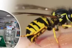 Bé gái 9 tuổi nguy kịch vì bị đàn ong vò vẽ đốt hơn 50 nốt