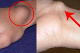 Tin tức sức khỏe - Thói quen ai cũng mắc phải khiến xương khớp “xuống cấp” không phanh