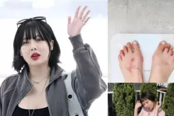 Làm đẹp - 'Mỹ nhân gợi cảm nhất showbiz' HyunA để lộ dấu hiệu đáng lo