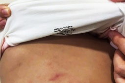 Cô giáo bị tố bạo hành bé gái 2 tuổi