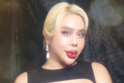 Bị miệt thị ngoại hình, chàng trai Nhật chi bộn tiền phẫu thuật thẩm mỹ