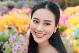 Giải trí - Ca sĩ Tố My ra sao sau 4 tháng nhập viện điều trị phình động mạch não?