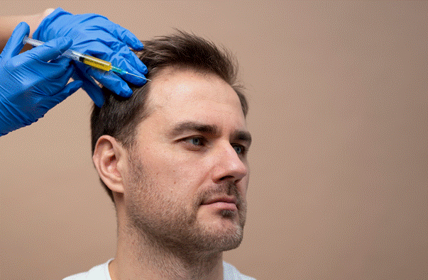 PRP kích thích sự tái tạo và cải thiện độ dày của tóc