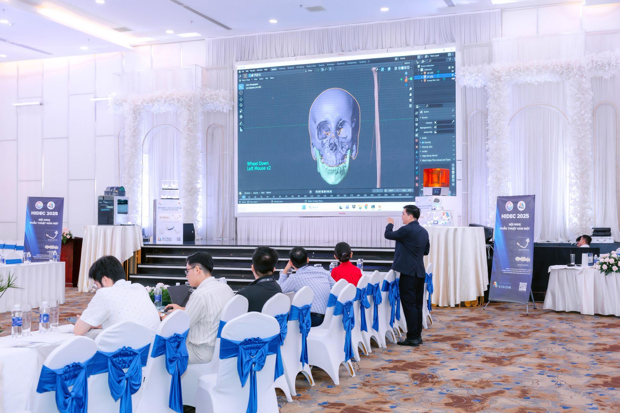 Bác sĩ minh họa thực hành ứng dụng lập kế hoạch phẫu thuật ảo kết hợp in 3D tại HIDEC 2025