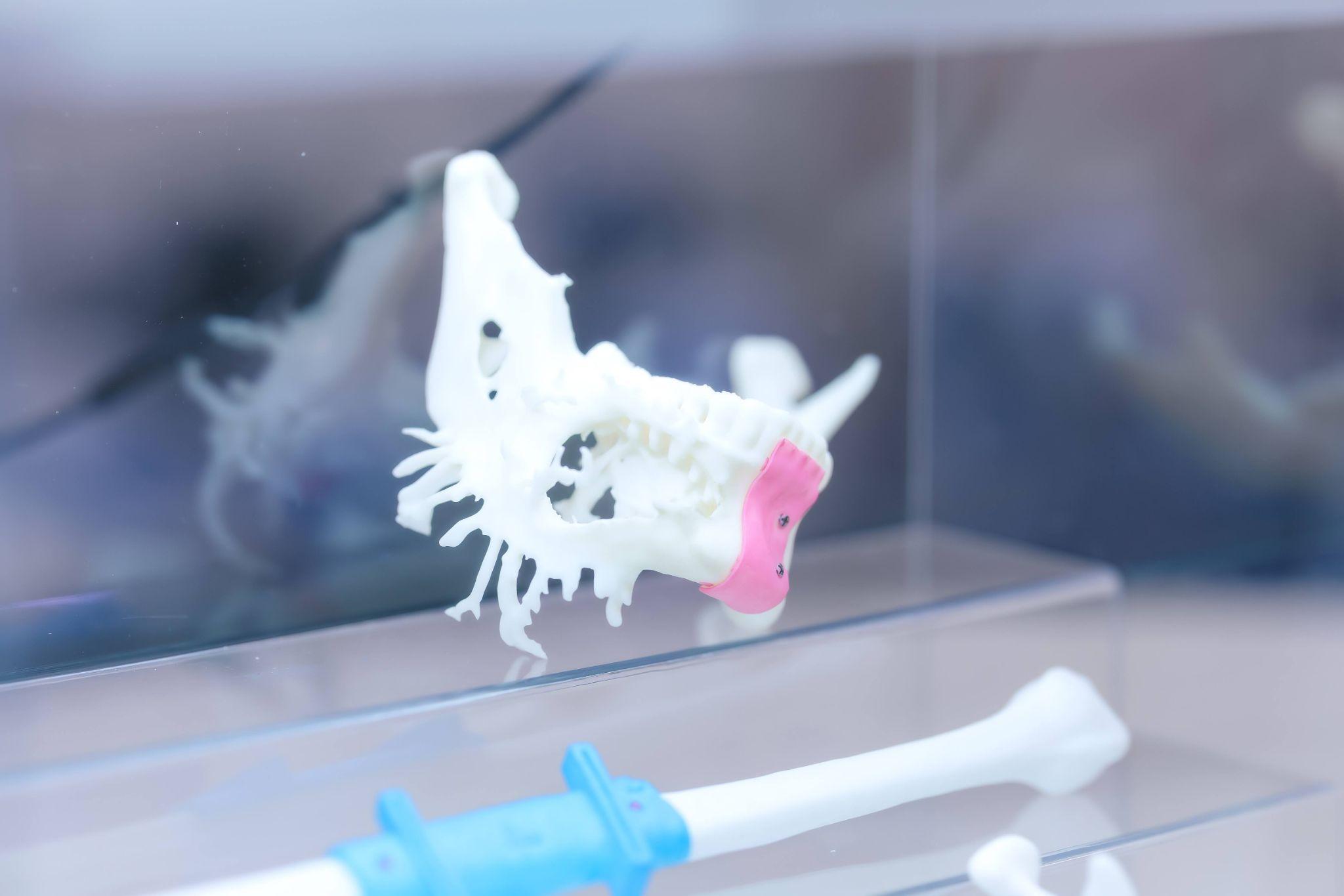 Mô hình 3D trong phẫu thuật hàm mặt