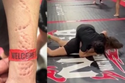 "Suarez nữ" khiến làng võ phẫn nộ, cắn đối thủ "không trượt phát nào"