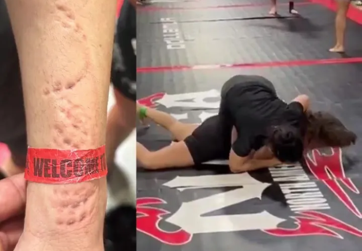 Hành động cắn đáng sợ của nữ võ sĩ người Mỹ