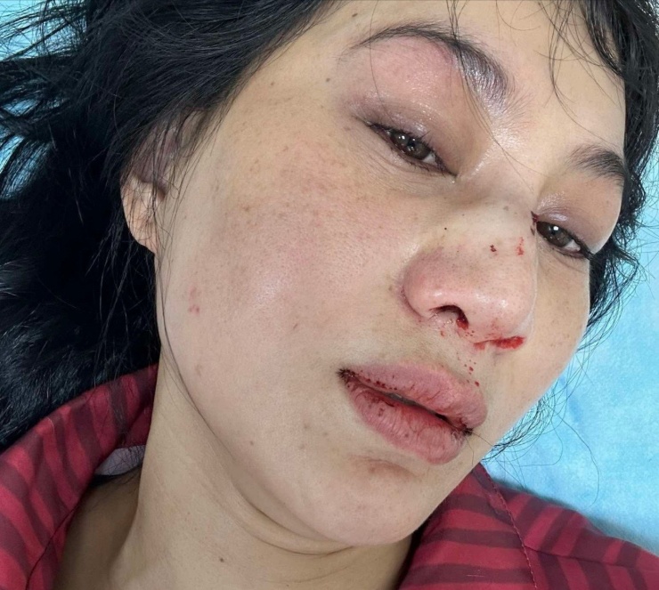 Phi Ngọc Ánh trước ca phẫu thuật.