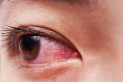 Sức khỏe đời sống - Dấu hiệu ở mắt tiết lộ 10 căn bệnh tiềm ẩn nguy hiểm