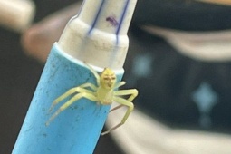 Thế giới - Nhện “mặt người” gây chú ý trên mạng Thái Lan