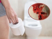 Dấu hiệu nhạy cảm cảnh báo 2 bệnh ung thư nguy hiểm và nhiều vấn đề khác