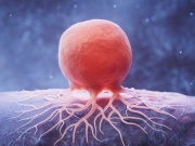 Thứ khiến chúng ta hạnh phúc có thể liên quan đến bệnh ung thư