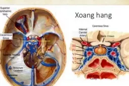 Sức khỏe đời sống - Đau đầu, sổ mũi tưởng nhẹ, nhưng có thể là một căn bệnh cực kỳ tàn khốc