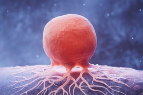 Thứ khiến chúng ta hạnh phúc có thể liên quan đến bệnh ung thư