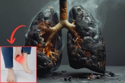 Tin tức sức khỏe - 3 “tín hiệu khẩn” cho thấy phổi đang “nguy kịch”, đi khám ngay kẻo ân hận cả đời!