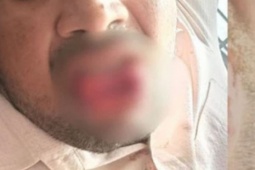 Bạn trẻ - Cuộc sống - Bị quấy rối trên đường, cô gái đáp trả theo cách khiến kẻ tấn công choáng váng