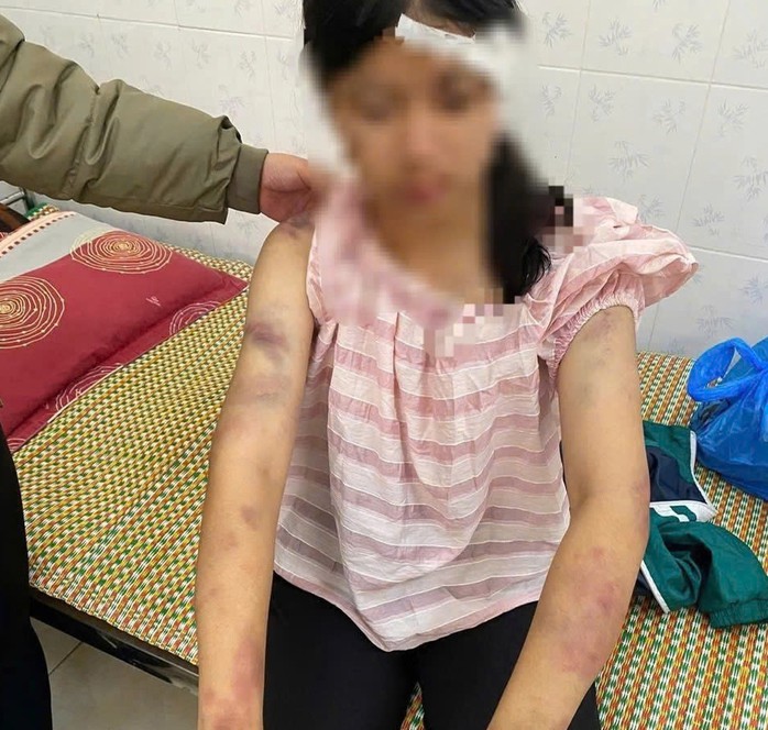 Bé gái 13 tuổi bị tra tấn.