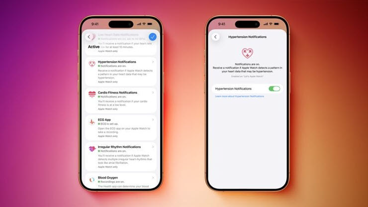 Những nâng cấp mới "đáng đồng tiền bát gạo" trên iOS 26.2 beta 3 - 2