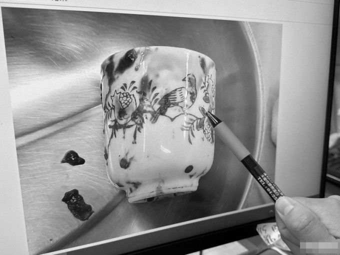 Chiếc cốc được lấy ra trong khoang chậu của người đàn ông ở thành phố Đài Trung, Đài Loan, Trung Quốc. Ảnh: The Liberty Times