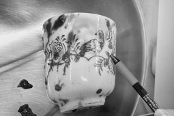 Người đàn ông hoại tử ruột vì chiếc cốc sứ trong hậu môn