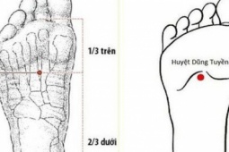 Bác sĩ y học cổ truyền khuyến cáo một số biện pháp phòng ngừa đột quỵ vào mùa lạnh