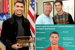 Bác sĩ thẩm mỹ hé lộ bí mật của Ronaldo,  " dao kéo "  gần hết khuôn mặt