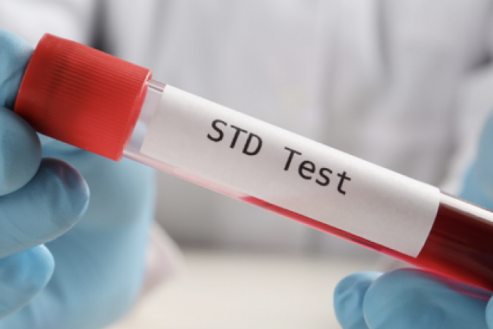 1 bệnh viện ở TP HCM ghi nhận 1 năm hơn 38.000 ca sùi mào gà