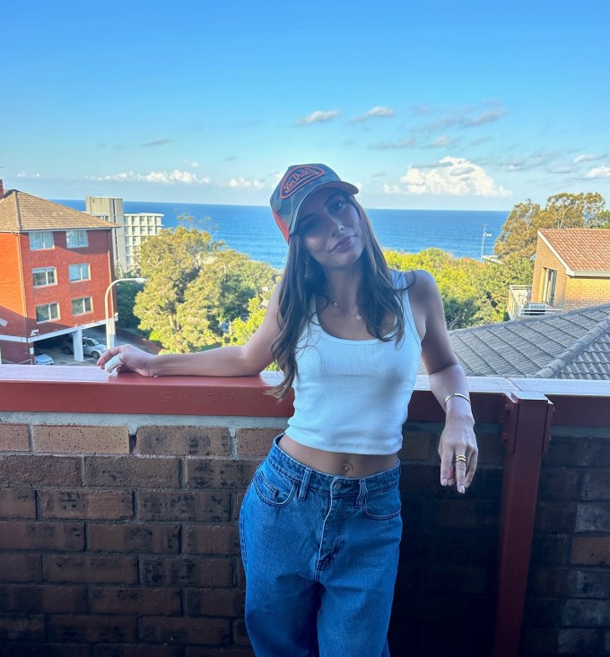 Hiện Claudia thường sử dụng găng tay hoặc băng kín để che ngón tay cái bị cắt bỏ một đoạn.