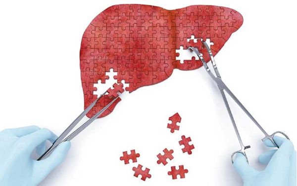 Dinh dưỡng chuyên biệt là một tấm lá chắn giúp chống lại sự suy mòn, đóng vai trò nền tảng trong việc ổn định và cải thiện chức năng gan. Nguồn: Pinterest