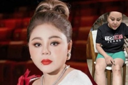 Lê Giang dừng đóng phim vì thoát vị đĩa đệm