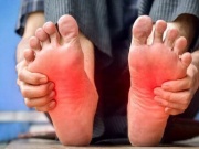 Dấu hiệu ở chân cảnh báo bệnh gan, suy tim và cục máu đông