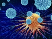 7 thói quen giúp bạn tránh xa ung thư