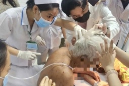 Cụ ông 74 tuổi ở Đồng Tháp bị ong đốt hơn 100 mũi đã tử vong