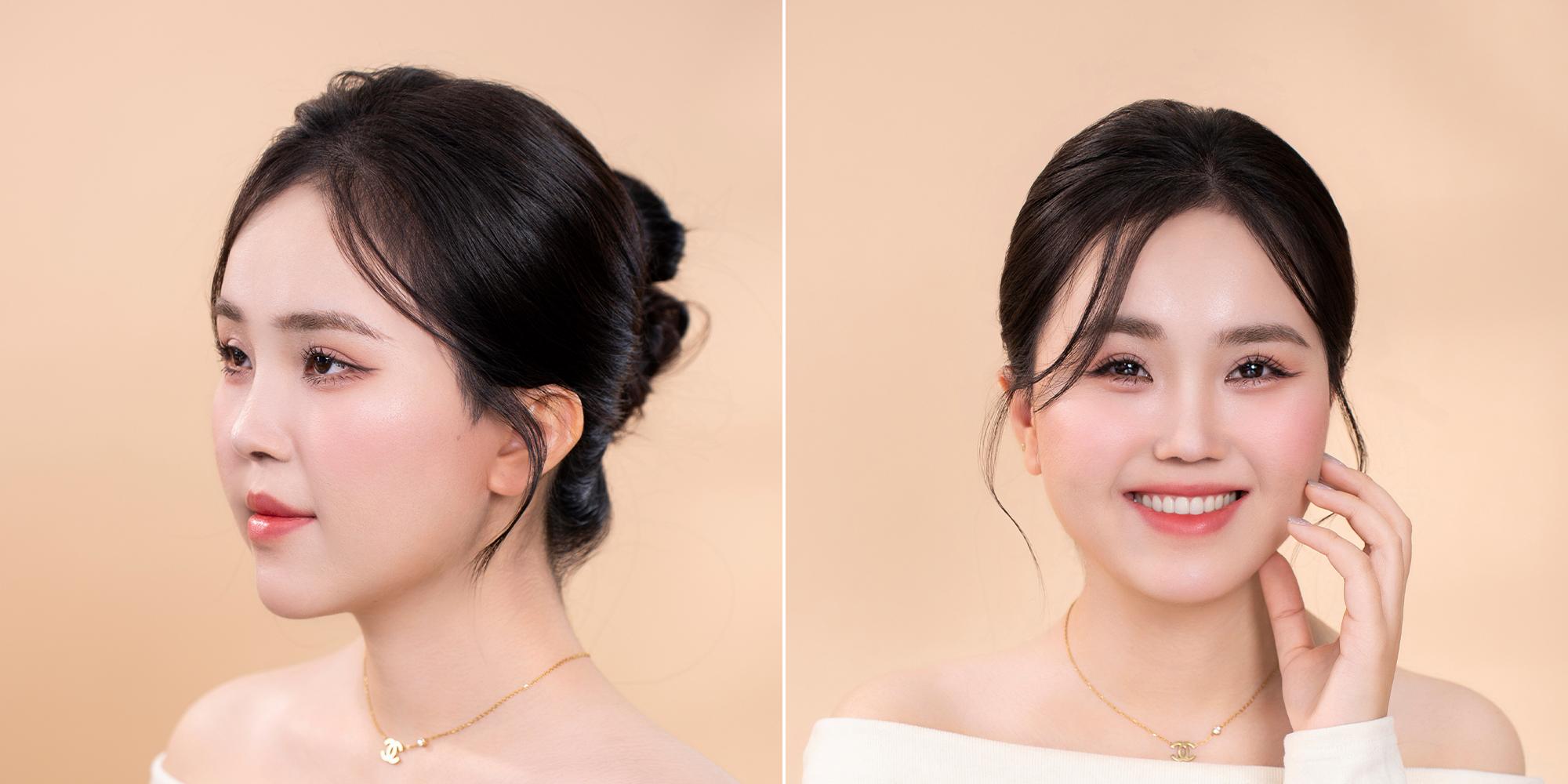 Bác sĩ Nguyễn Thành Nhân: Người miệt mài trên hành trình tái sinh diện mạo