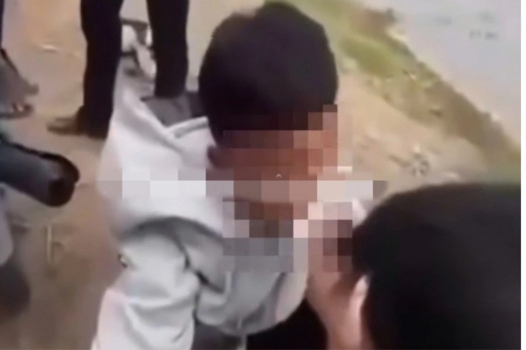 Hình ảnh nam sinh H. ở An Giang bị nhóm bạn hành hung và nhét băng vệ sinh vào miệng. Ảnh cắt từ clip.