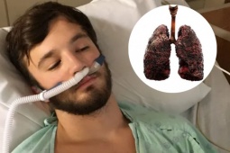 Tin tức sức khỏe - 5 “kẻ thù không đội trời chung” của phổi, lập tức tránh xa nếu không muốn tương lai phải thở máy