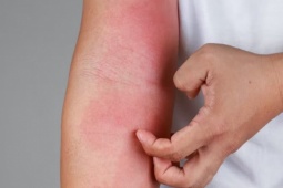 Sức khỏe đời sống - 5 dấu hiệu cơ thể bị nhiễm ký sinh trùng