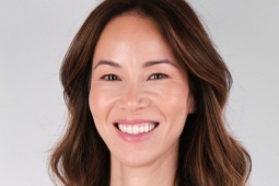 Làm đẹp - 3 bước ngừa lão hóa bác sĩ da liễu không bỏ qua